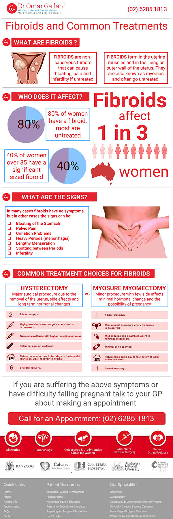 Fibroids and Common Treatments