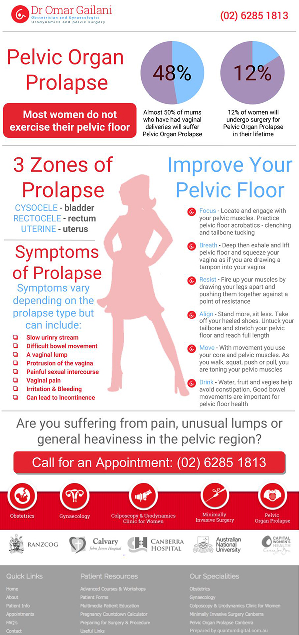 Pelvic Organ Prolapse Canberra | Cysocele | Rectocele & Uterine Deakin