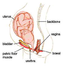 urinary incontinence