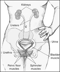 urinary incontinence