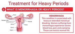 treatment-for-heavy-periods-blog